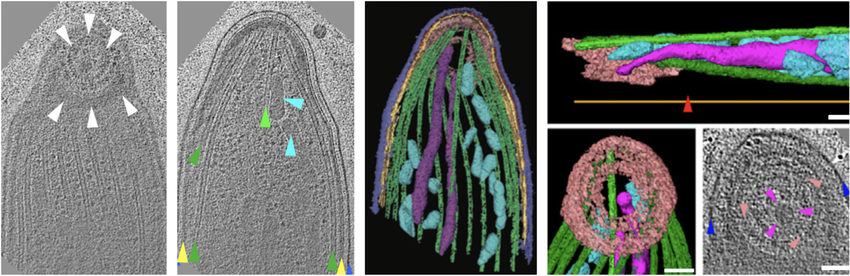 Rings in the apex of an apicomplexan parasite. Selected tomographic sections of the apical complex of a Plasmodium sporozoite. 